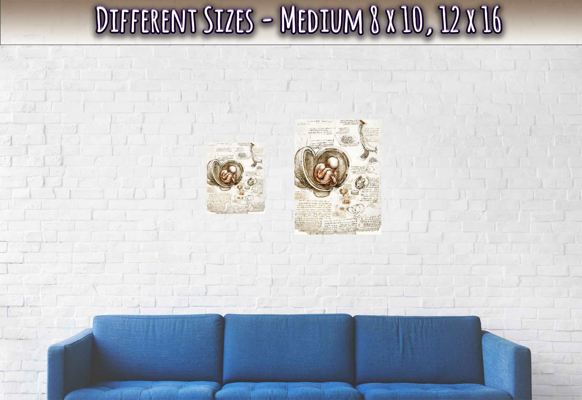 Leonardo Da Vinci Print, Studies Of Foetus In The Womb Poster - WallArtPrints4U