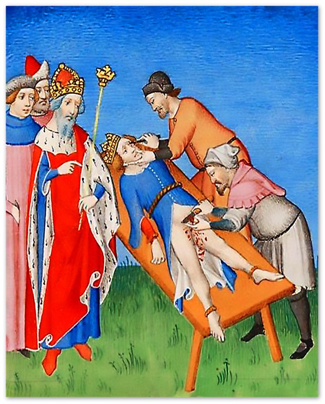 Medieval Torture Poster Castration Blinding Brutal Medieval Torture Print - WallArtPrints4U